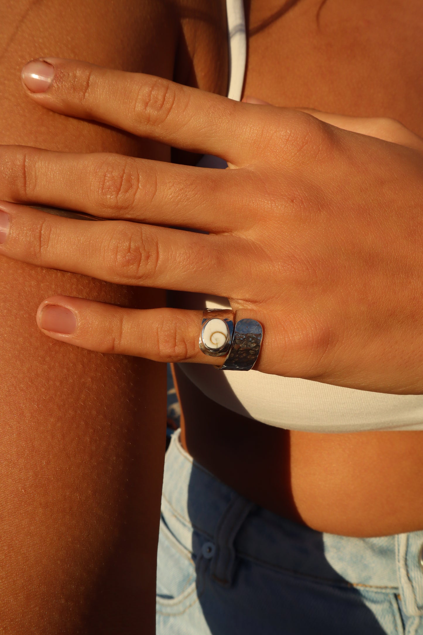 Adjustable Operculum Ring